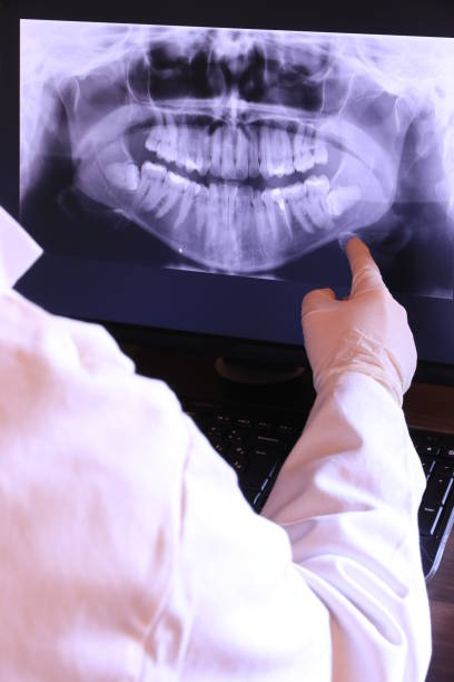 Best Emergency Wisdom Tooth Extraction in Avalon, CA